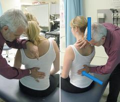 Can I get rid of the vertebral artery syndrome?